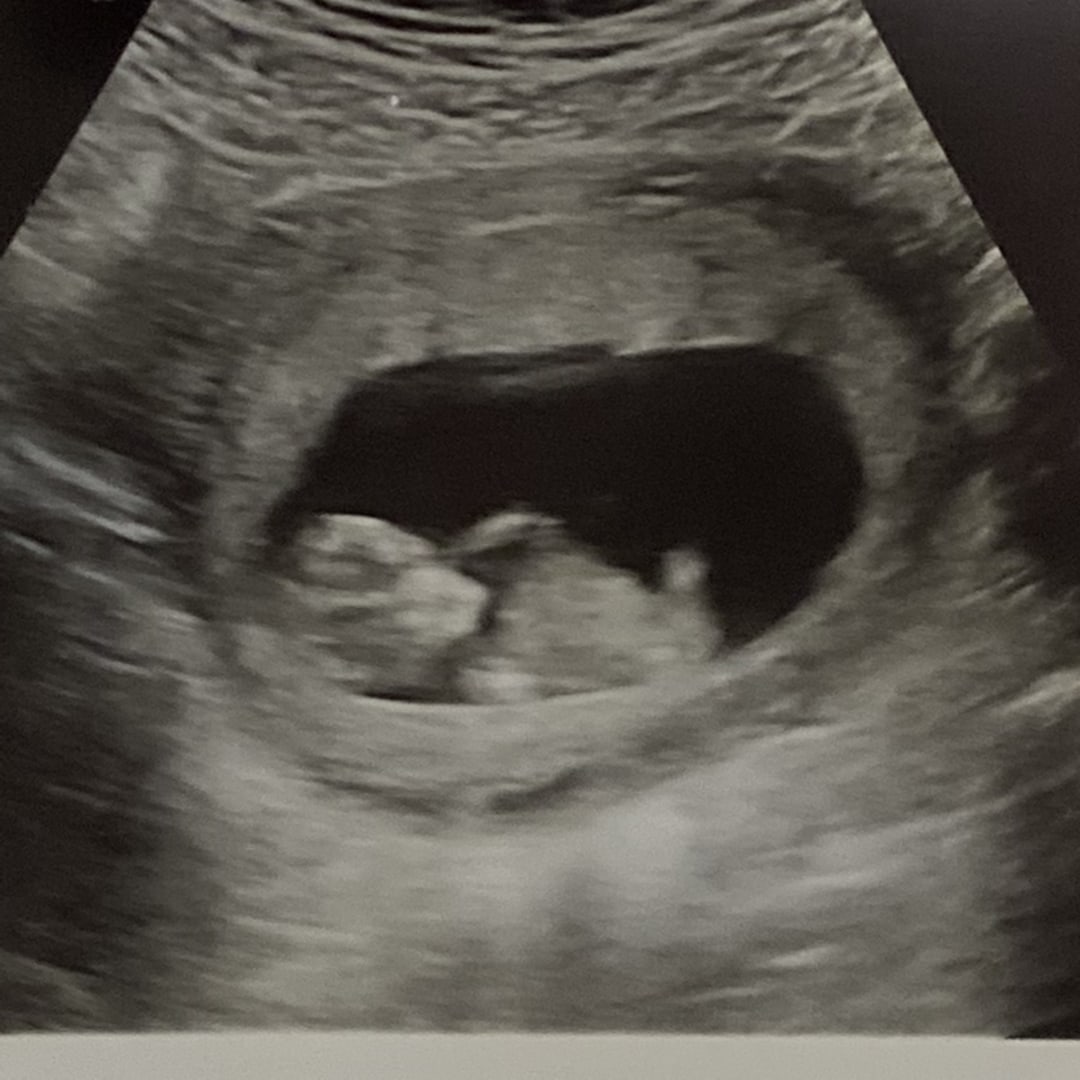 Photo shared by Brynna for their Babylist baby registry.