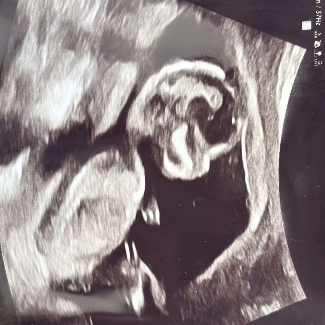 Photo shared by Angela for their Babylist baby registry.
