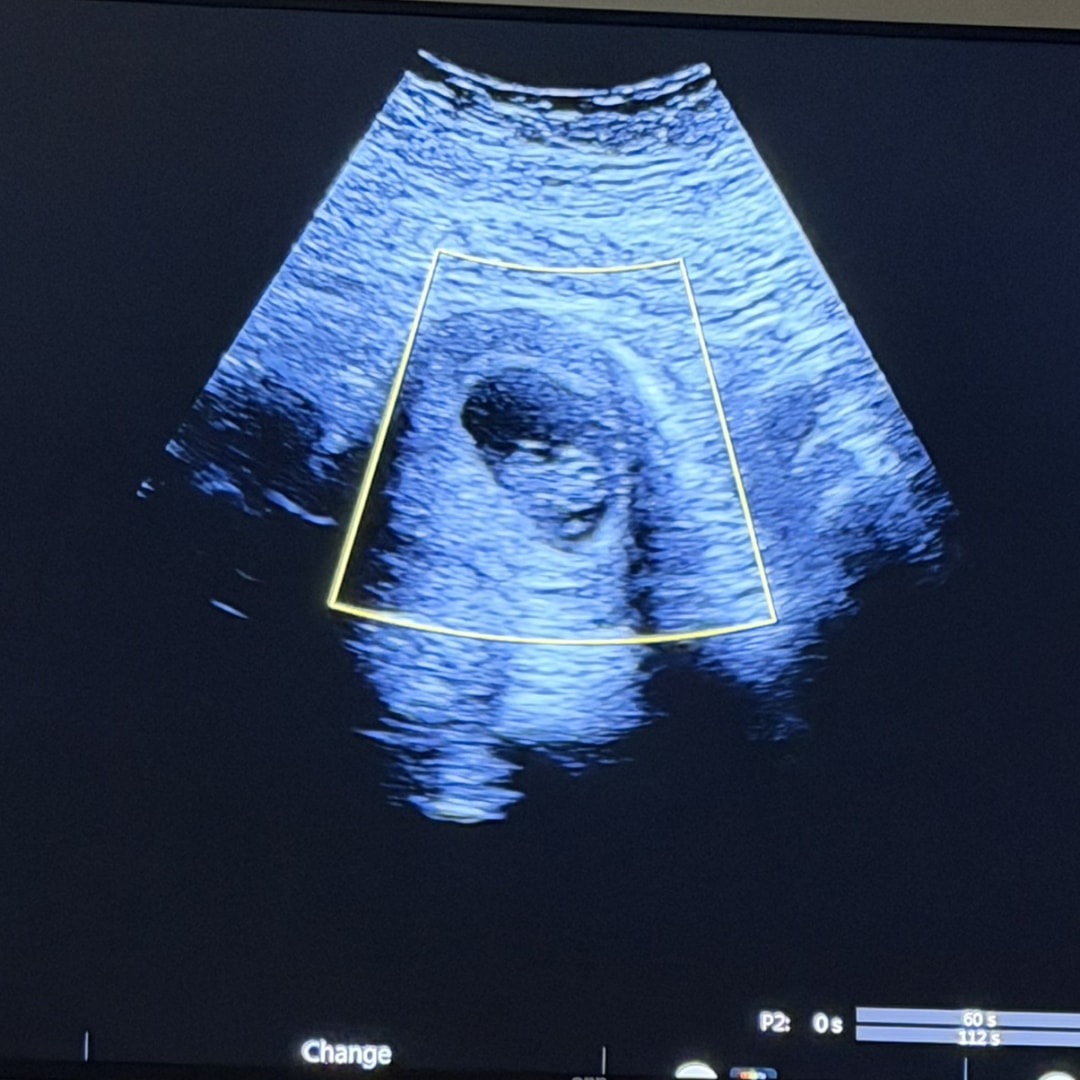 Photo shared by Dyandra for their Babylist baby registry.