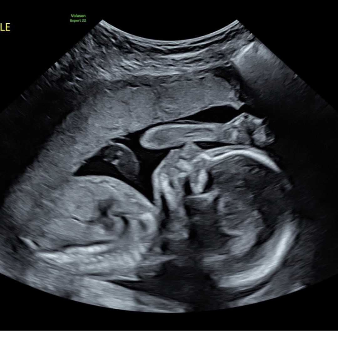 Photo shared by Hailey for their Babylist baby registry.