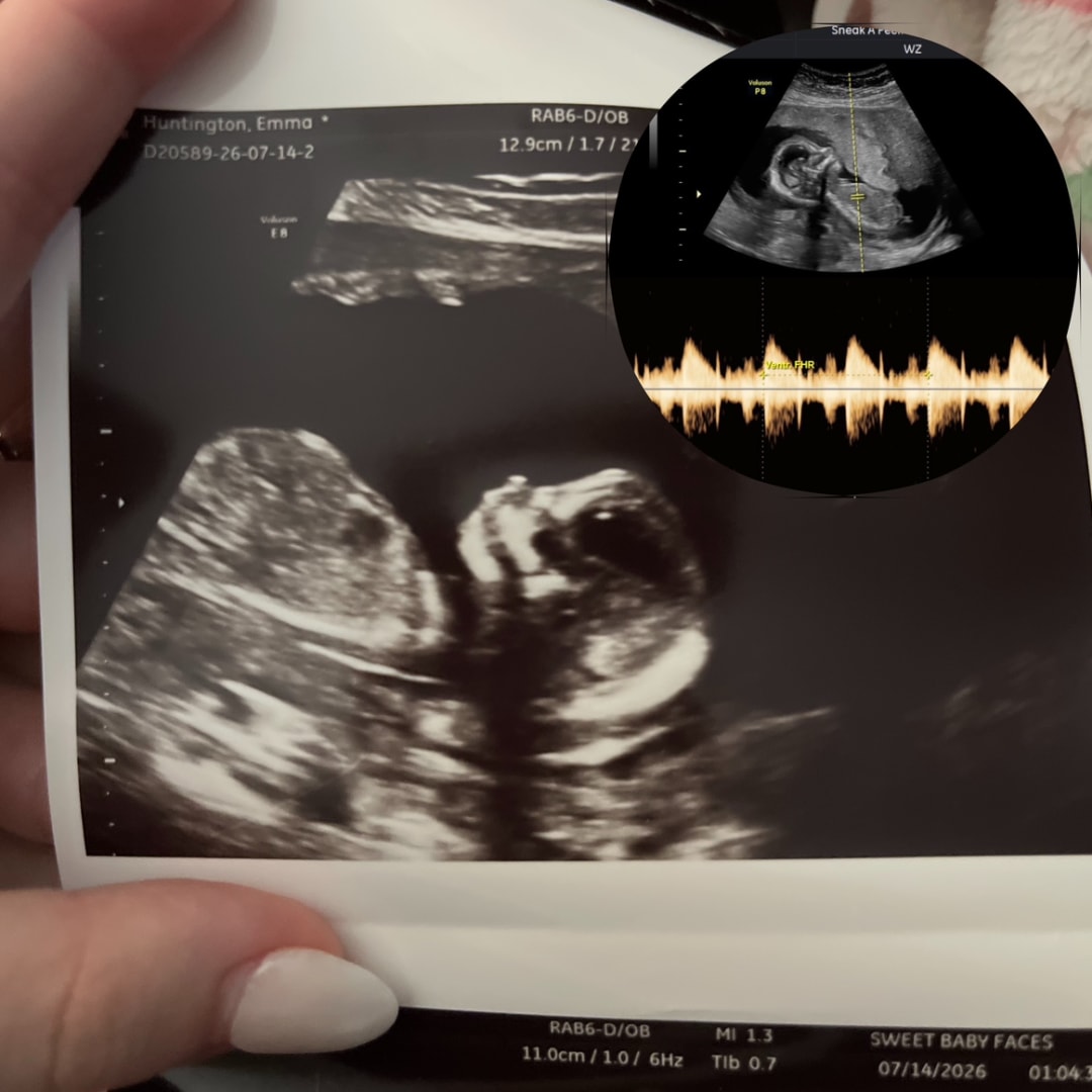 Photo shared by Emma for their Babylist baby registry.