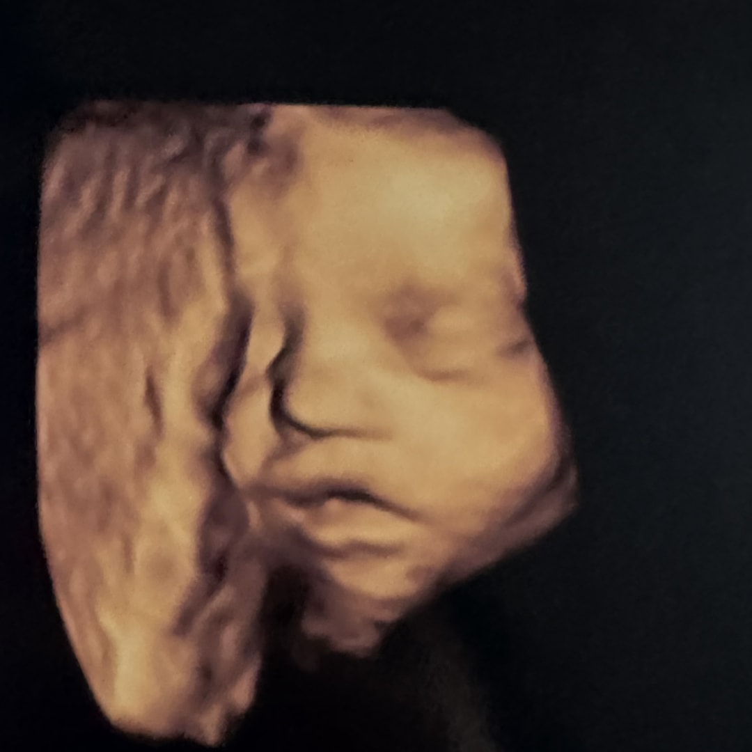 Photo shared by Nancy for their Babylist baby registry.