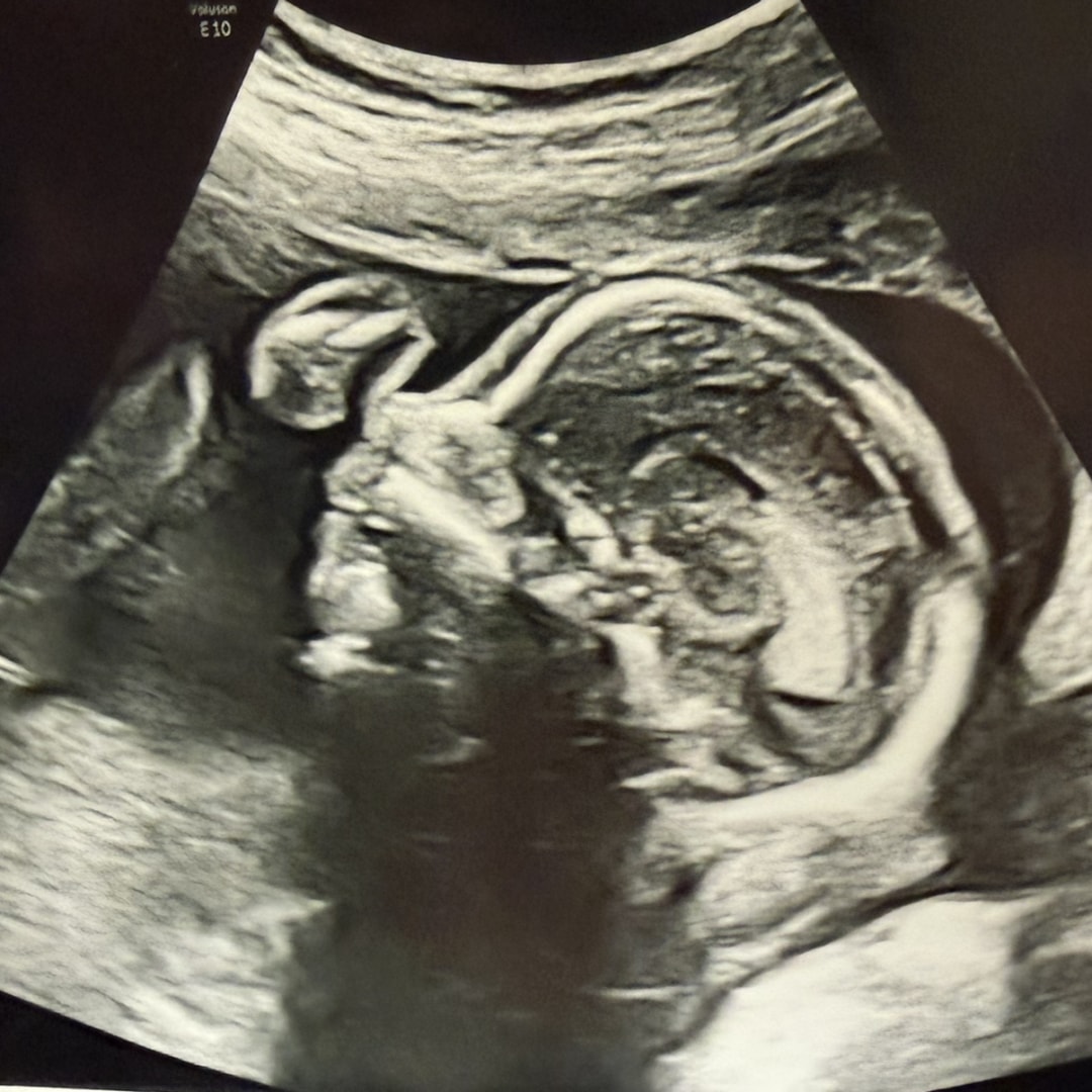 Photo shared by Ashley for their Babylist baby registry.