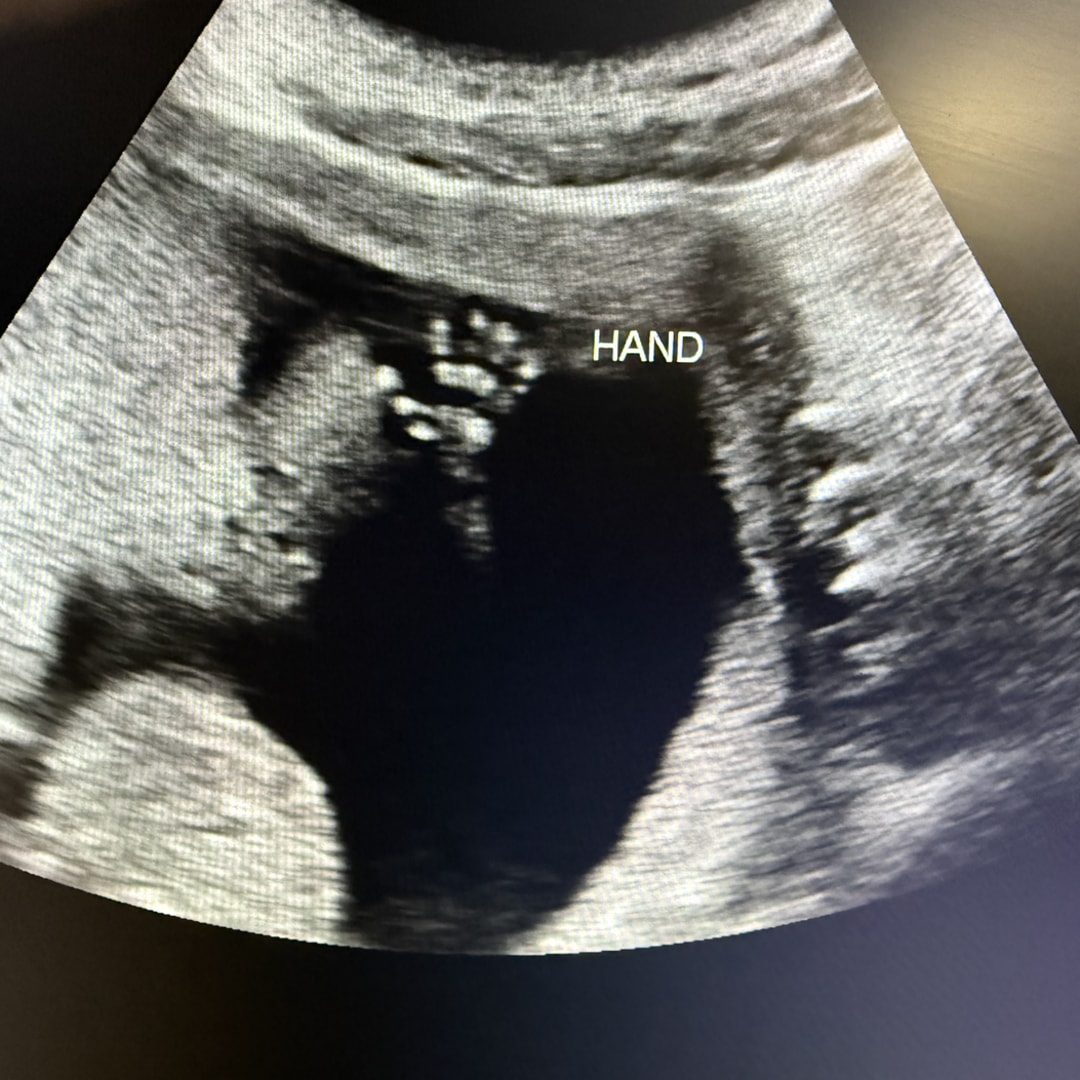 Photo shared by Courtney for their Babylist baby registry.