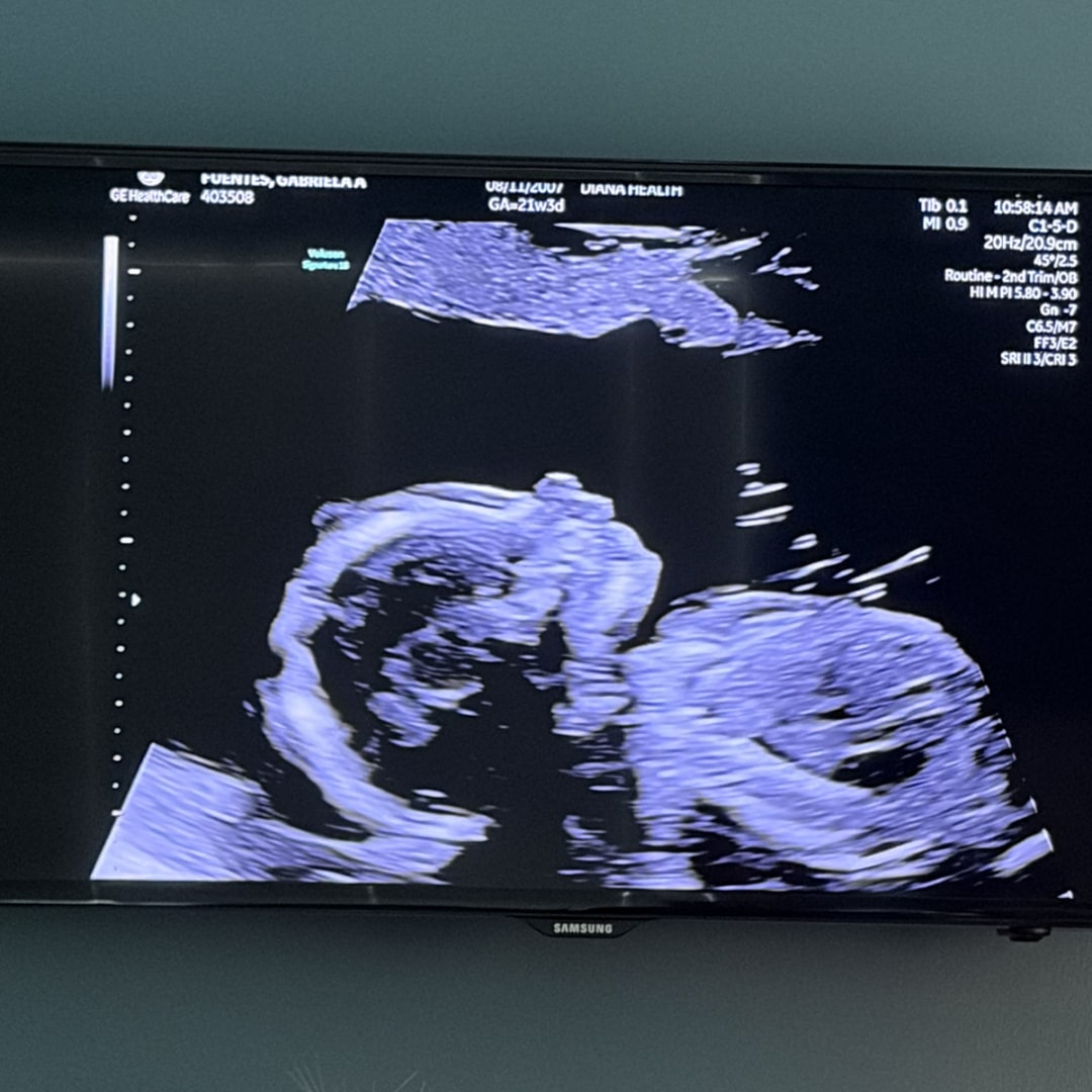 Photo shared by Gabriela for their Babylist baby registry.