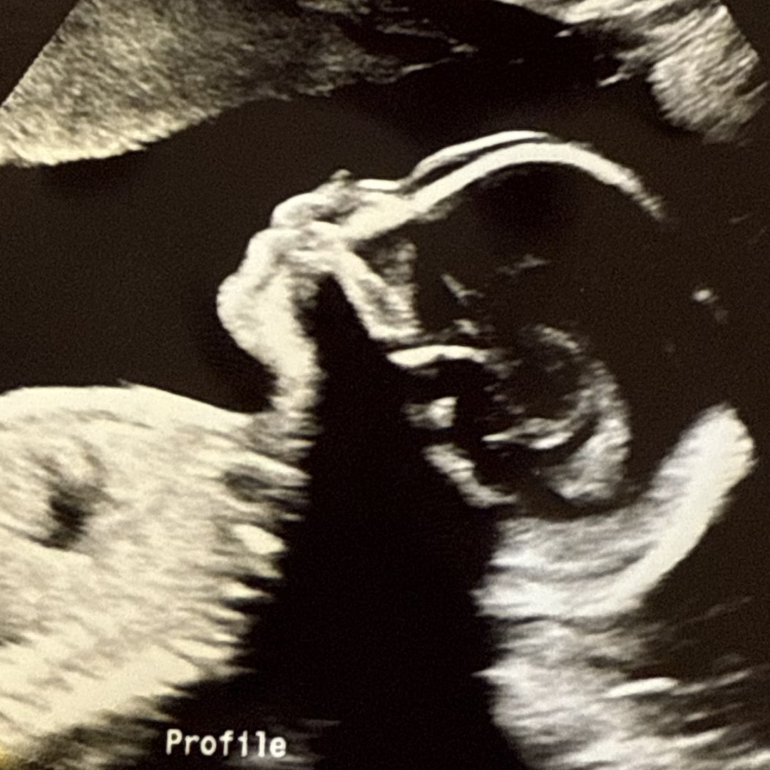 Photo shared by Ashleigh for their Babylist baby registry.