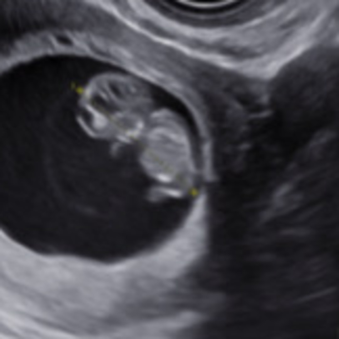 Photo shared by Alexis for their Babylist baby registry.