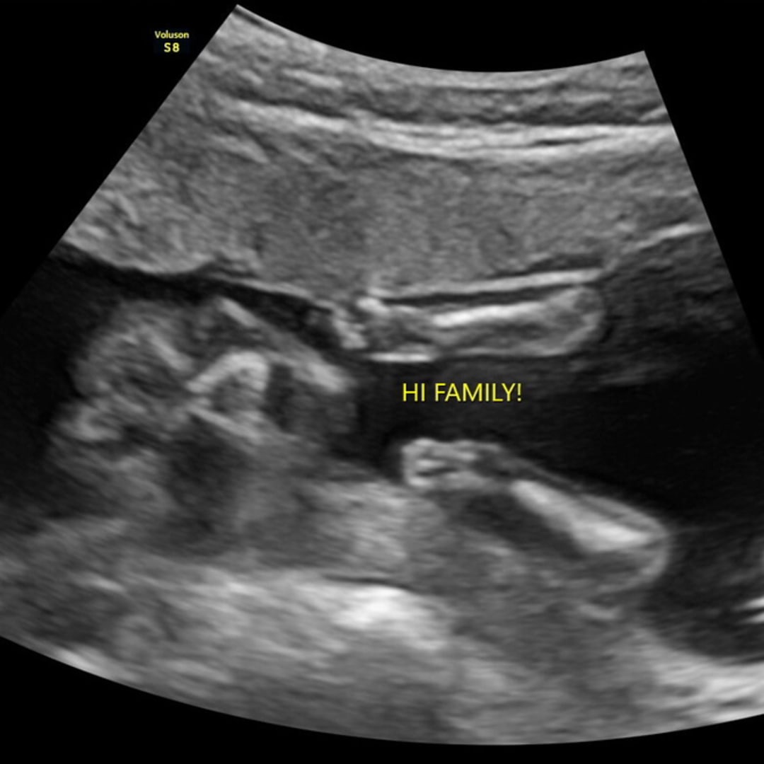 Photo shared by Jolie for their Babylist baby registry.