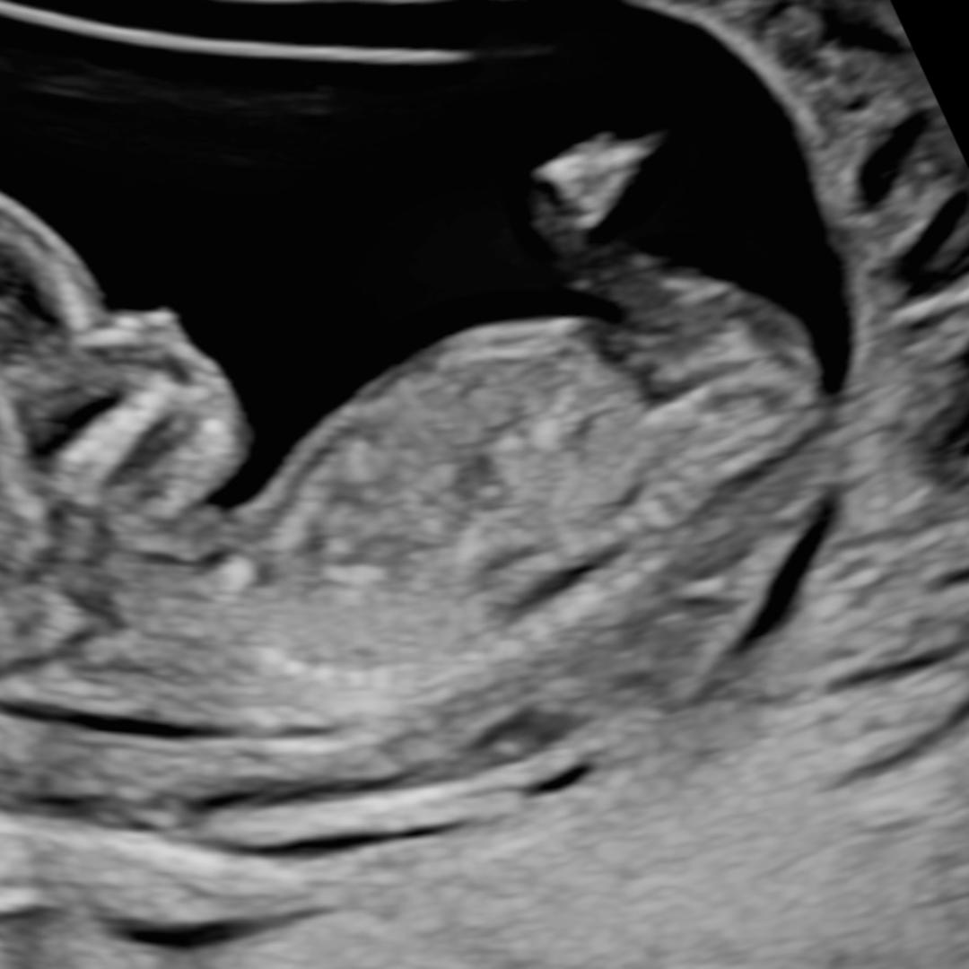 Photo shared by Kylie for their Babylist baby registry.