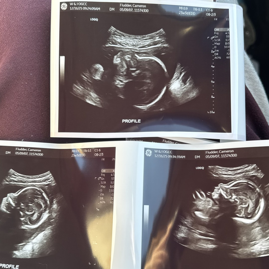 Photo shared by Cameron for their Babylist baby registry.