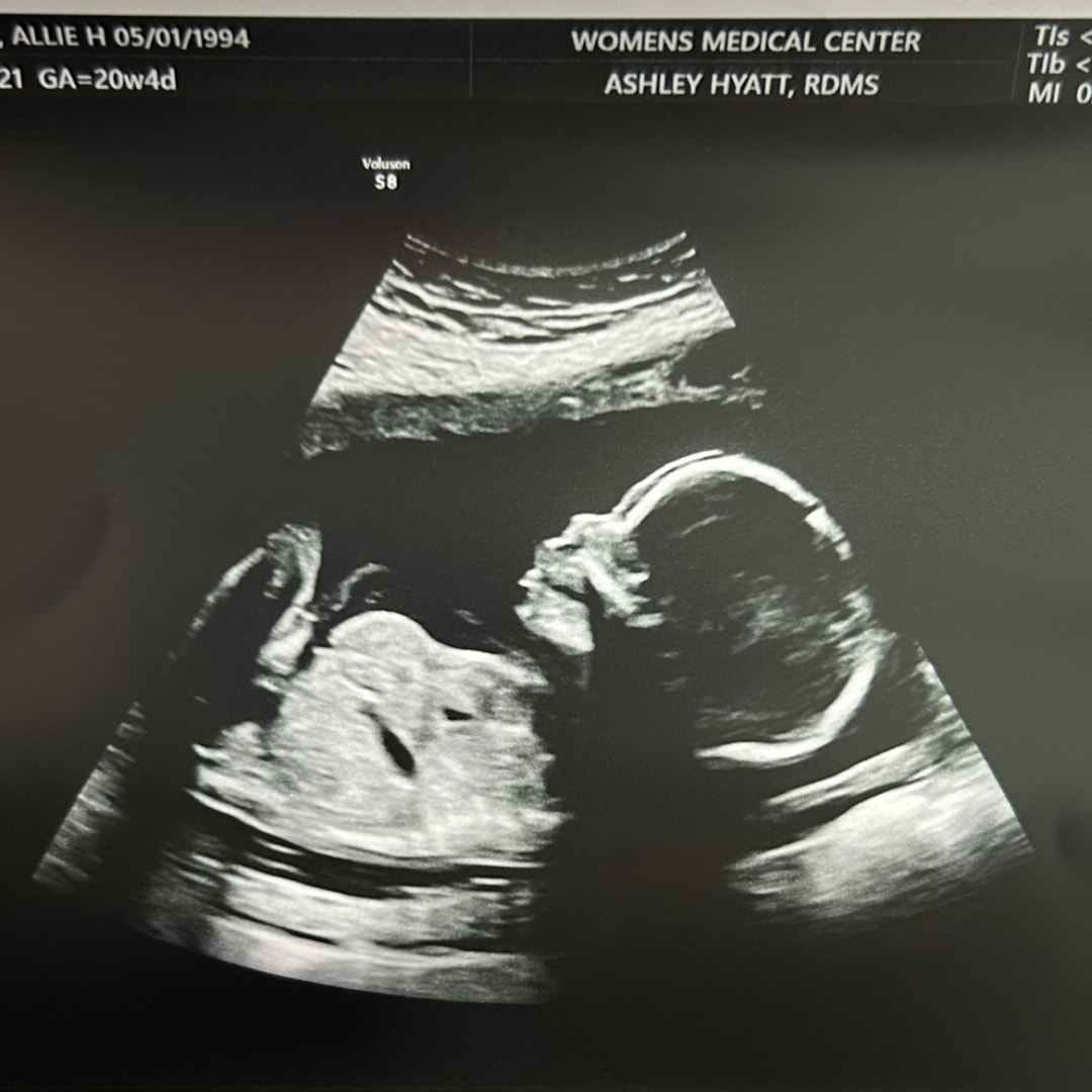 Photo shared by Allie for their Babylist baby registry.