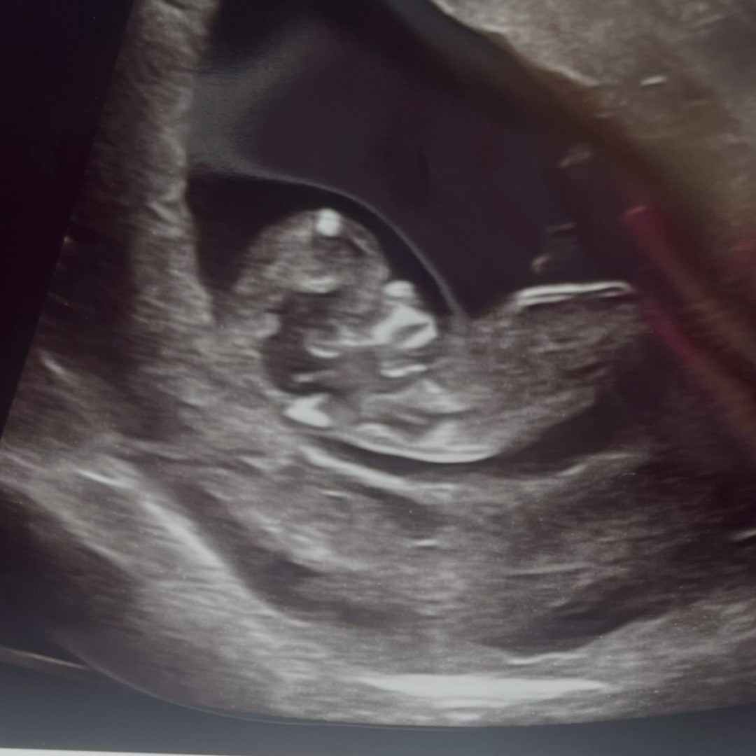 Photo shared by Jennifer for their Babylist baby registry.