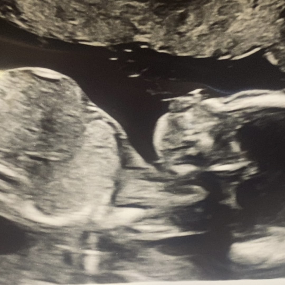 Photo shared by Pauline for their Babylist baby registry.