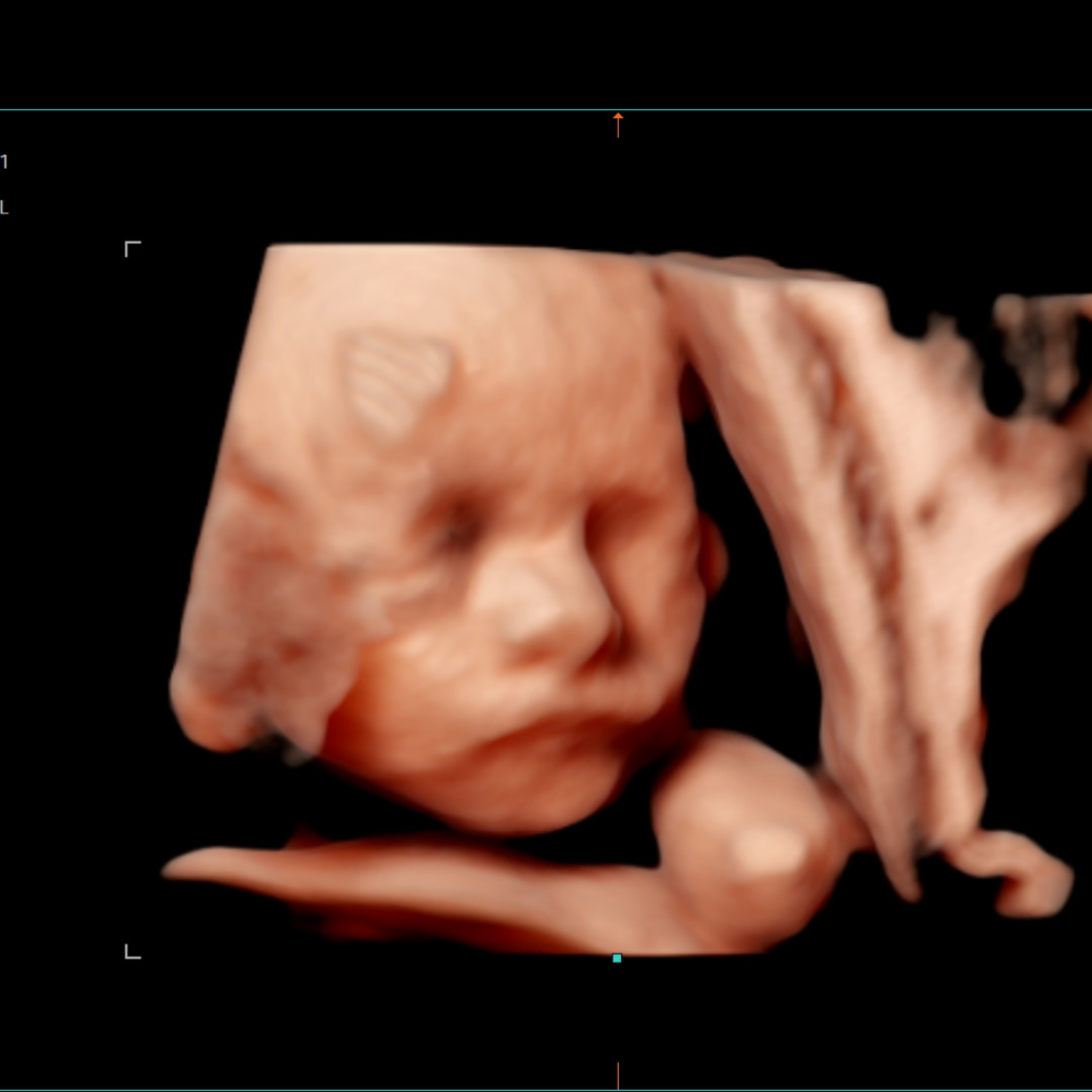 Photo shared by Ana for their Babylist baby registry.