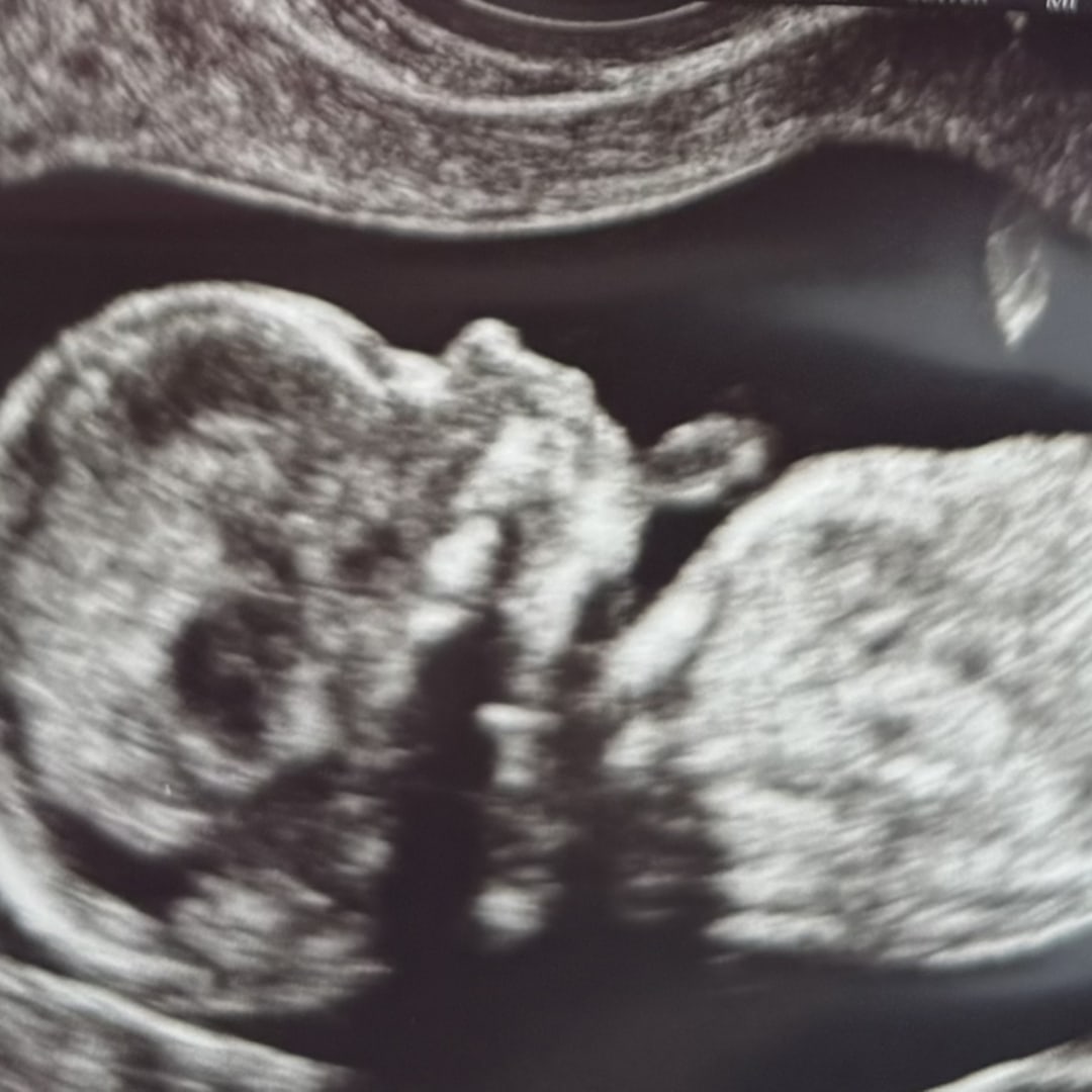 Photo shared by Brooklyn for their Babylist baby registry.