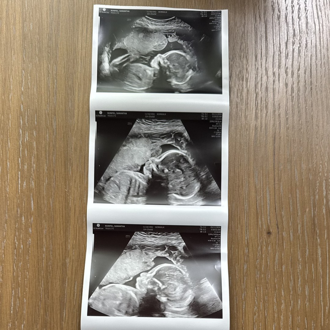 Photo shared by Samantha for their Babylist baby registry.