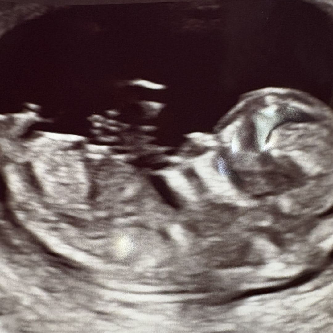 Photo shared by Emily for their Babylist baby registry.