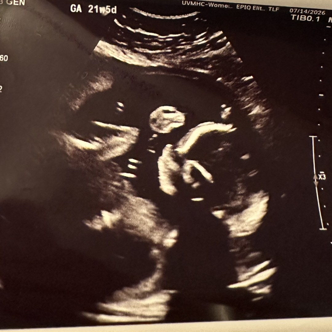 Photo shared by Aili for their Babylist baby registry.