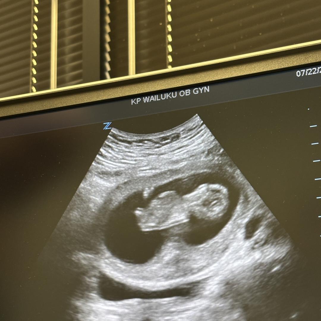 Photo shared by Bernadette for their Babylist baby registry.