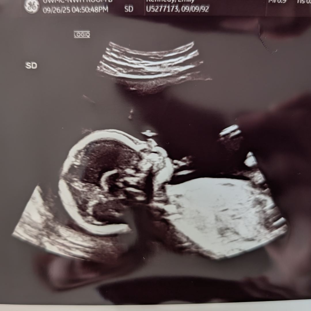 Photo shared by Emily for their Babylist baby registry.