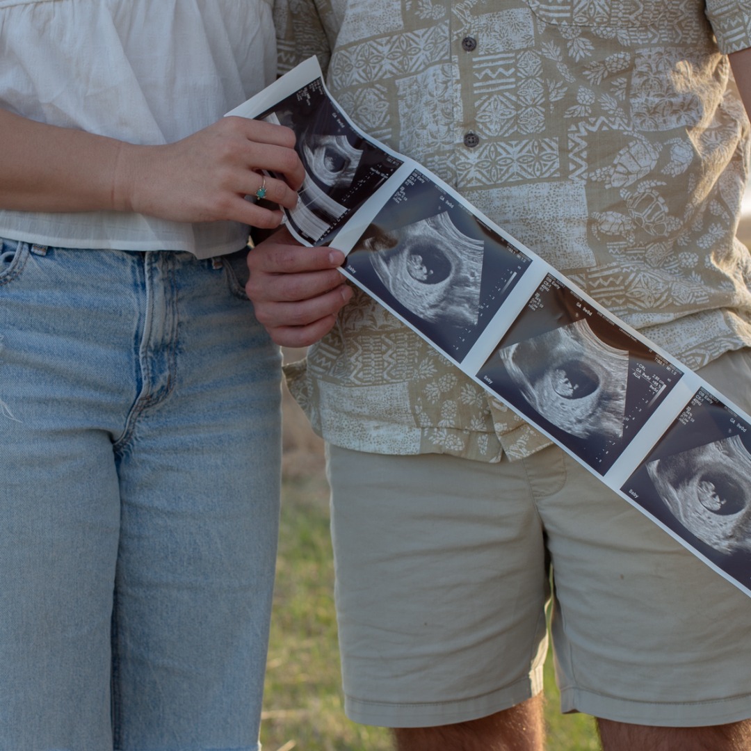 Photo shared by Olivia for their Babylist baby registry.