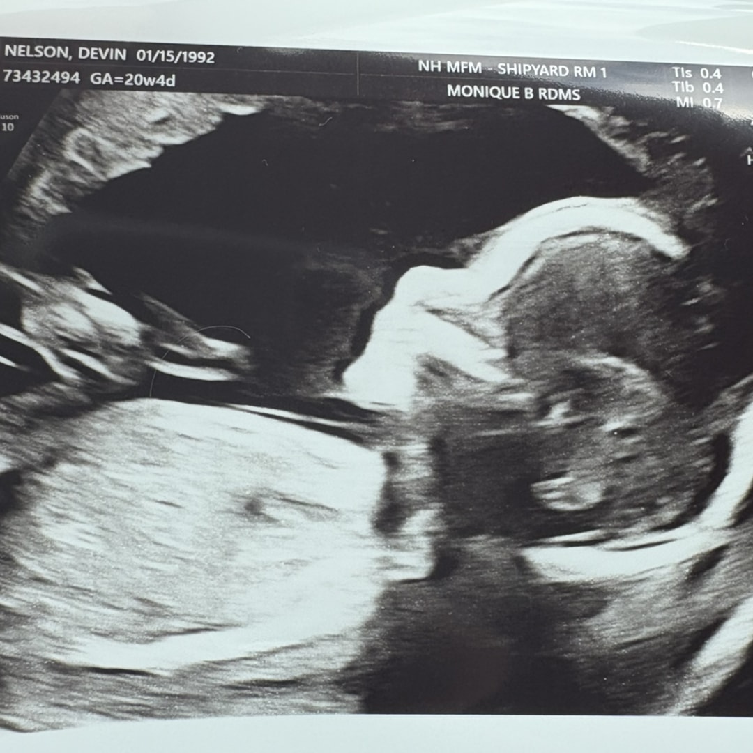 Photo shared by Devin for their Babylist baby registry.