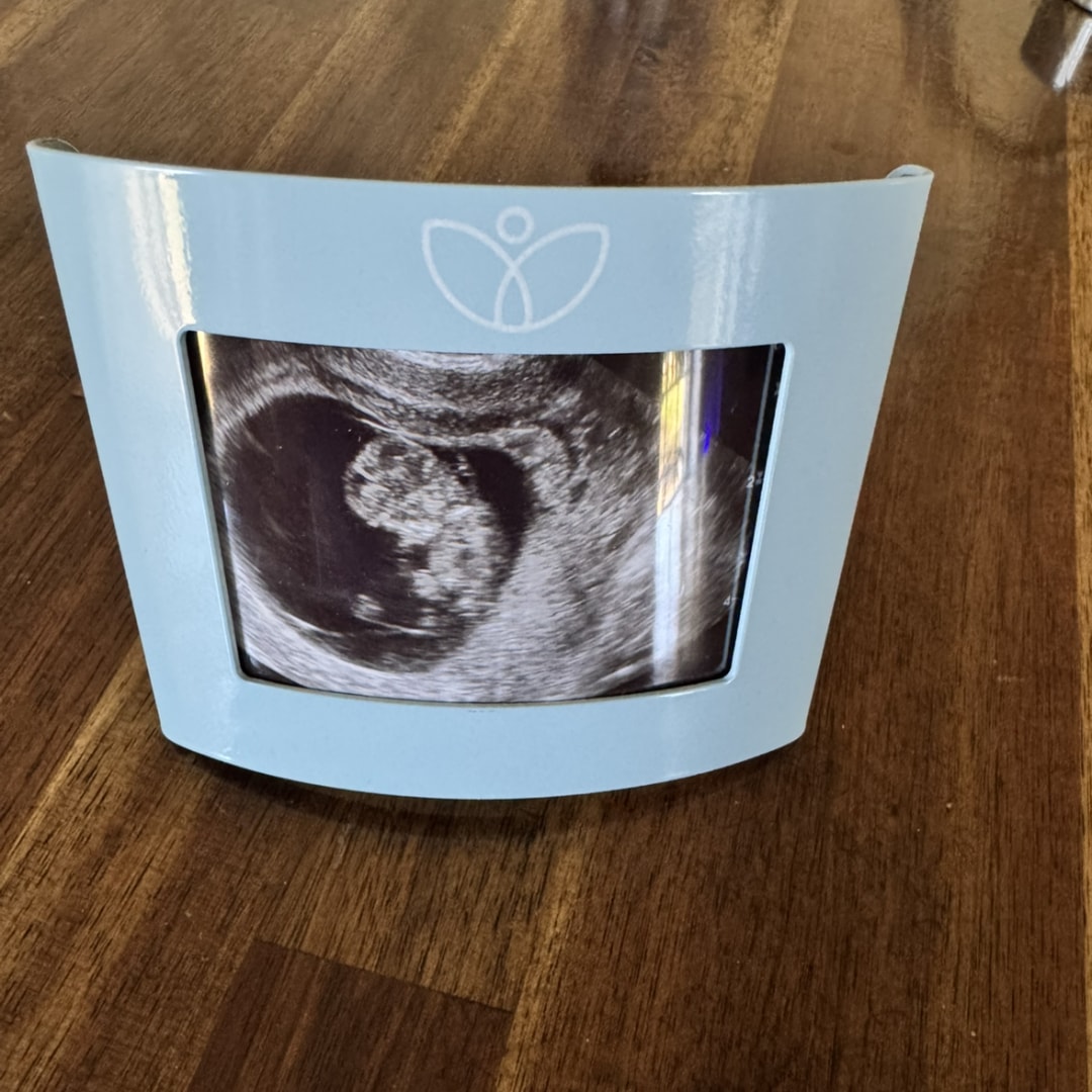 Photo shared by Meagan for their Babylist baby registry.