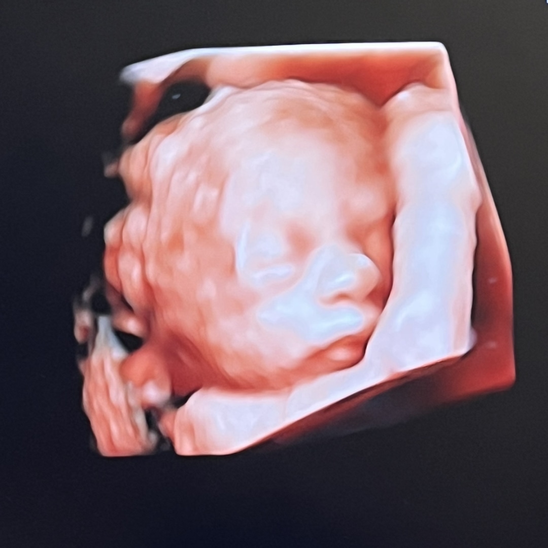 Photo shared by DeAnna for their Babylist baby registry.