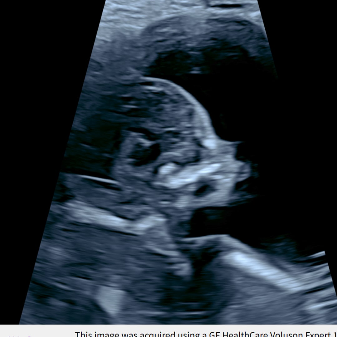 Photo shared by Nikki for their Babylist baby registry.