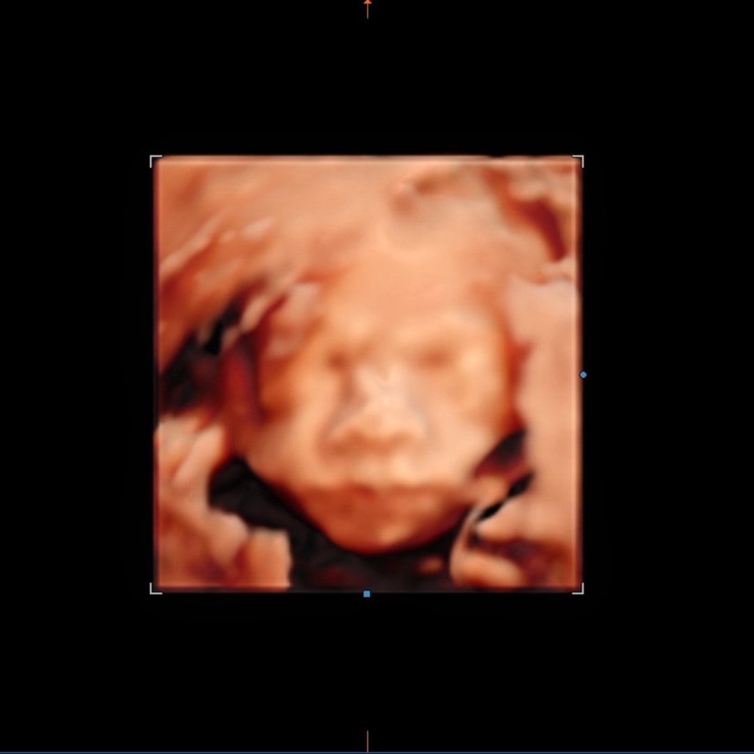 Photo shared by Elly for their Babylist baby registry.