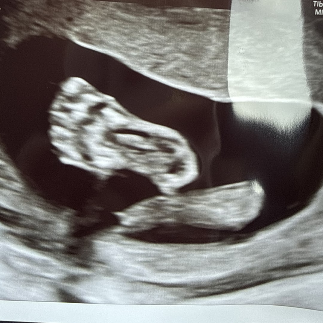 Photo shared by Abigail for their Babylist baby registry.
