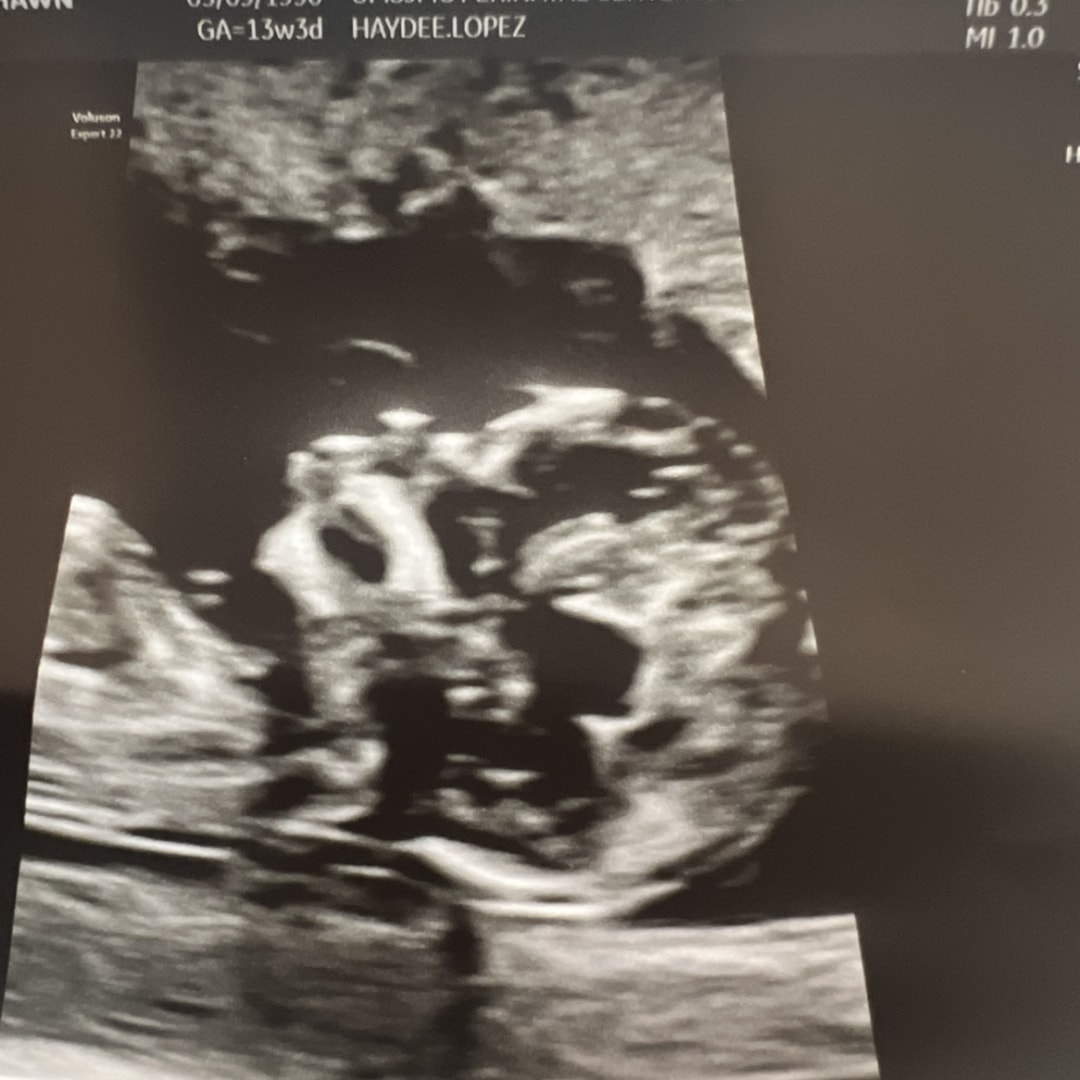 Photo shared by Cierra for their Babylist baby registry.