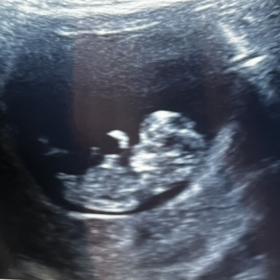 Photo shared by Savannah for their Babylist baby registry.