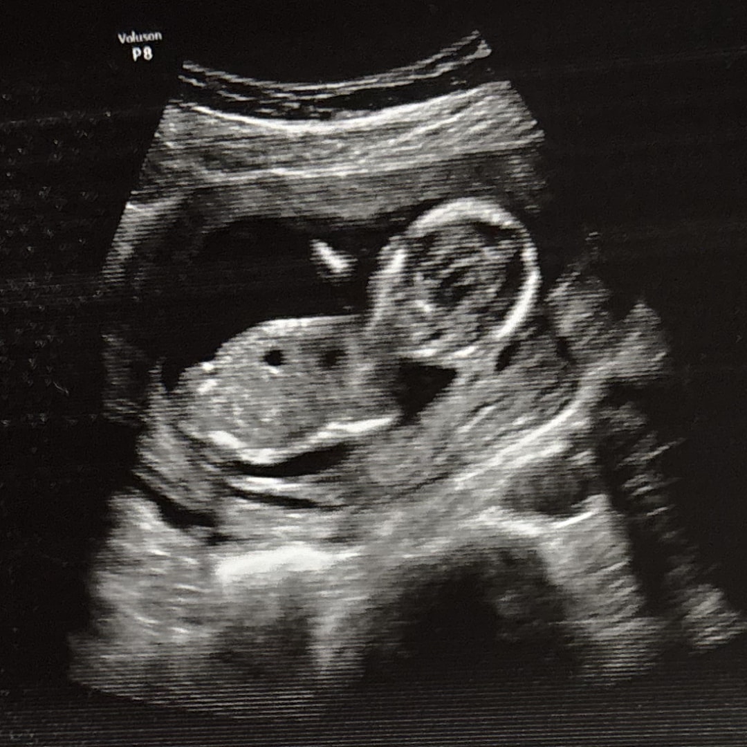 Photo shared by Amber for their Babylist baby registry.