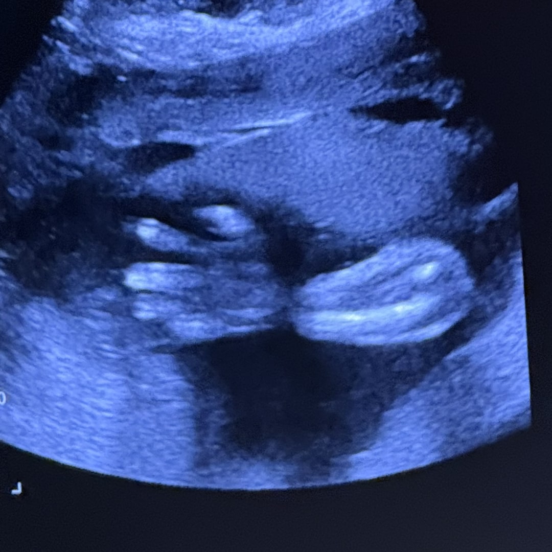 Photo shared by Celina for their Babylist baby registry.