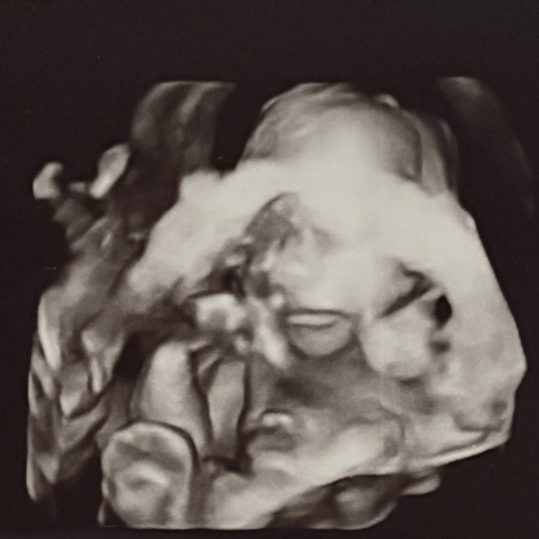 Photo shared by Hannah for their Babylist baby registry.