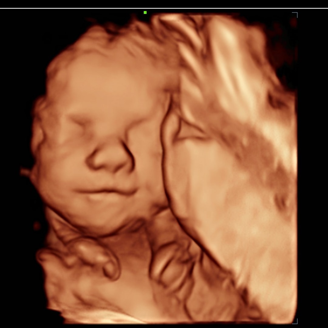 Photo shared by Alaina for their Babylist baby registry.