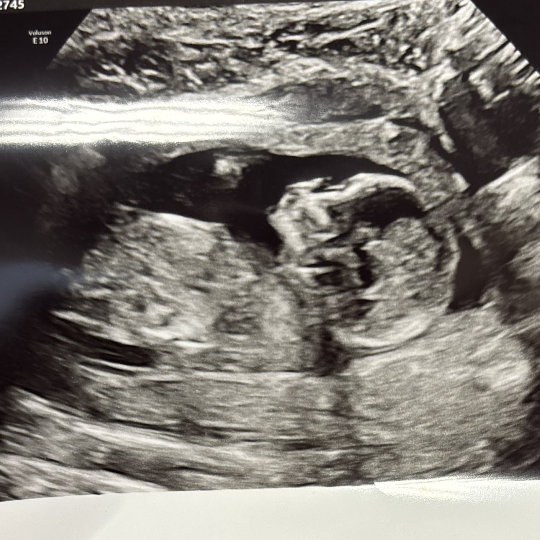 Photo shared by Domonique for their Babylist baby registry.