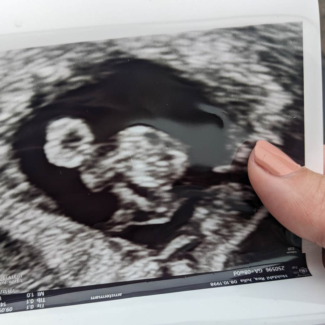 Photo shared by Julia for their Babylist baby registry.