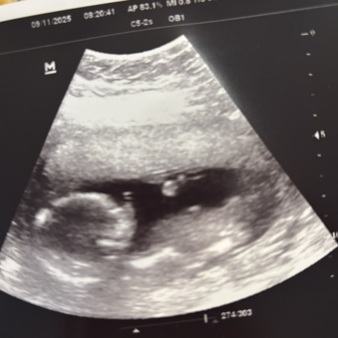 Photo shared by Juliann for their Babylist baby registry.
