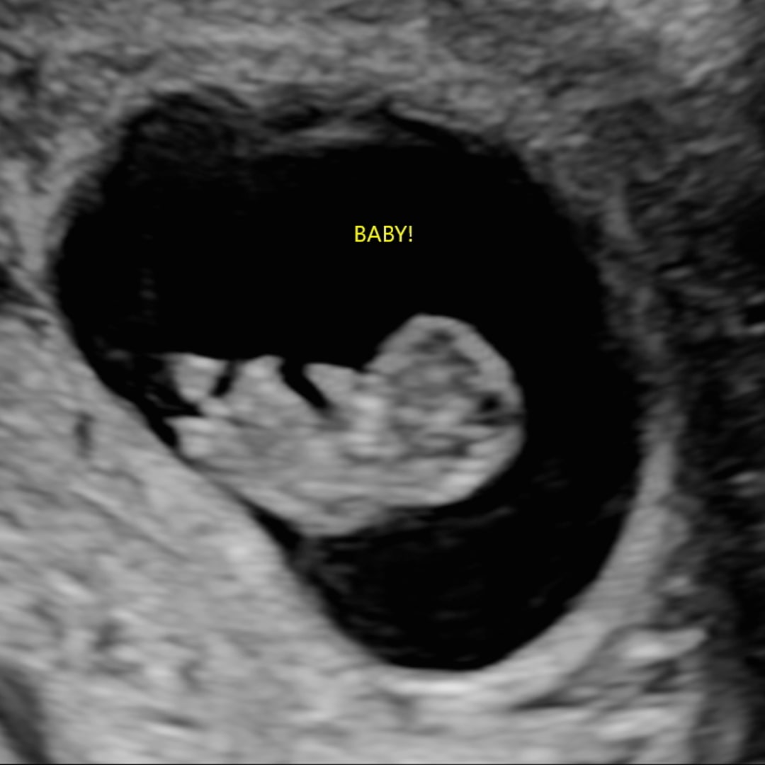 Photo shared by Cheyanne for their Babylist baby registry.