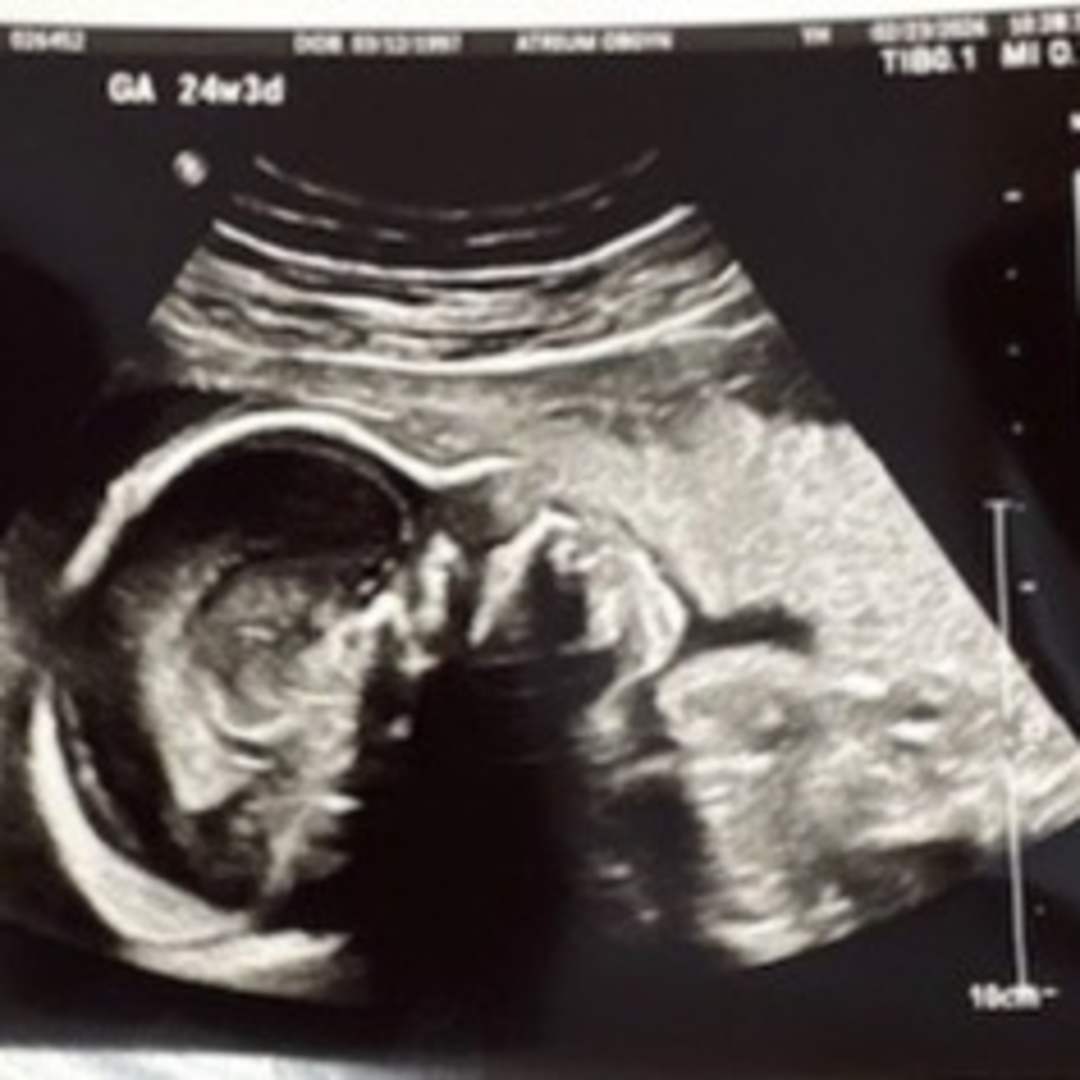 Photo shared by Hannah for their Babylist baby registry.