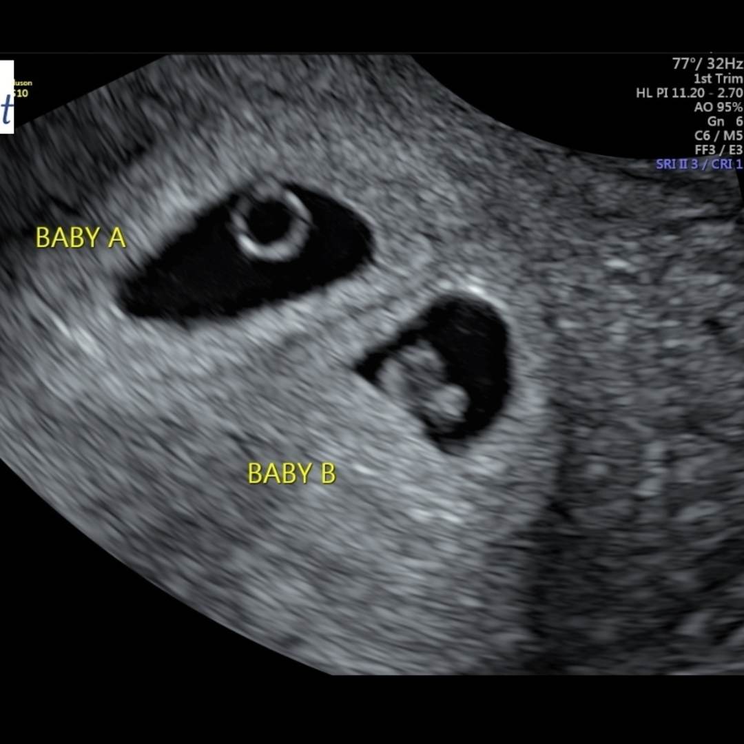 Photo shared by Keely for their Babylist baby registry.