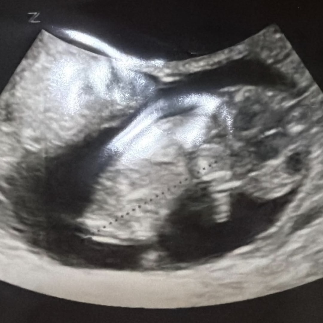 Photo shared by Stephanie for their Babylist baby registry.