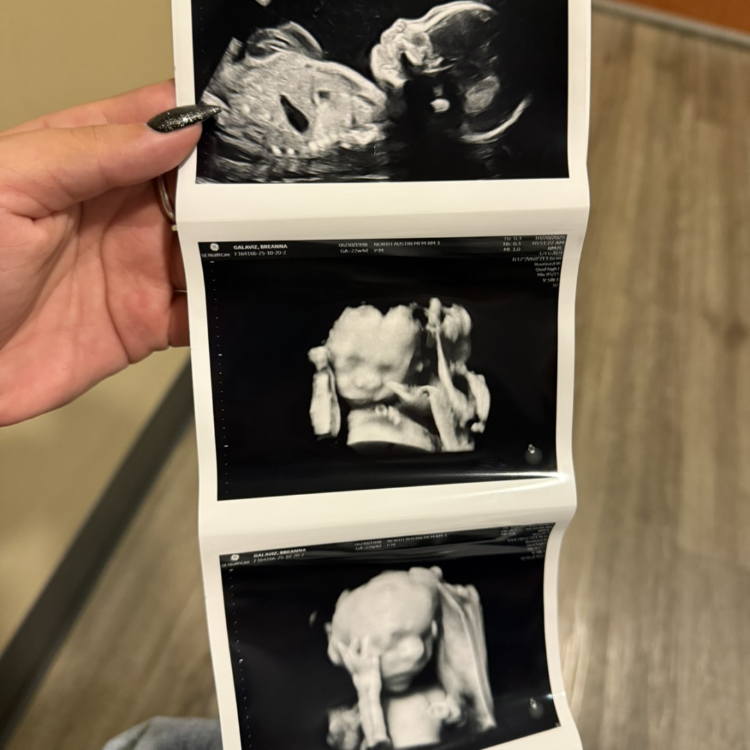 Photo shared by Breanna for their Babylist baby registry.
