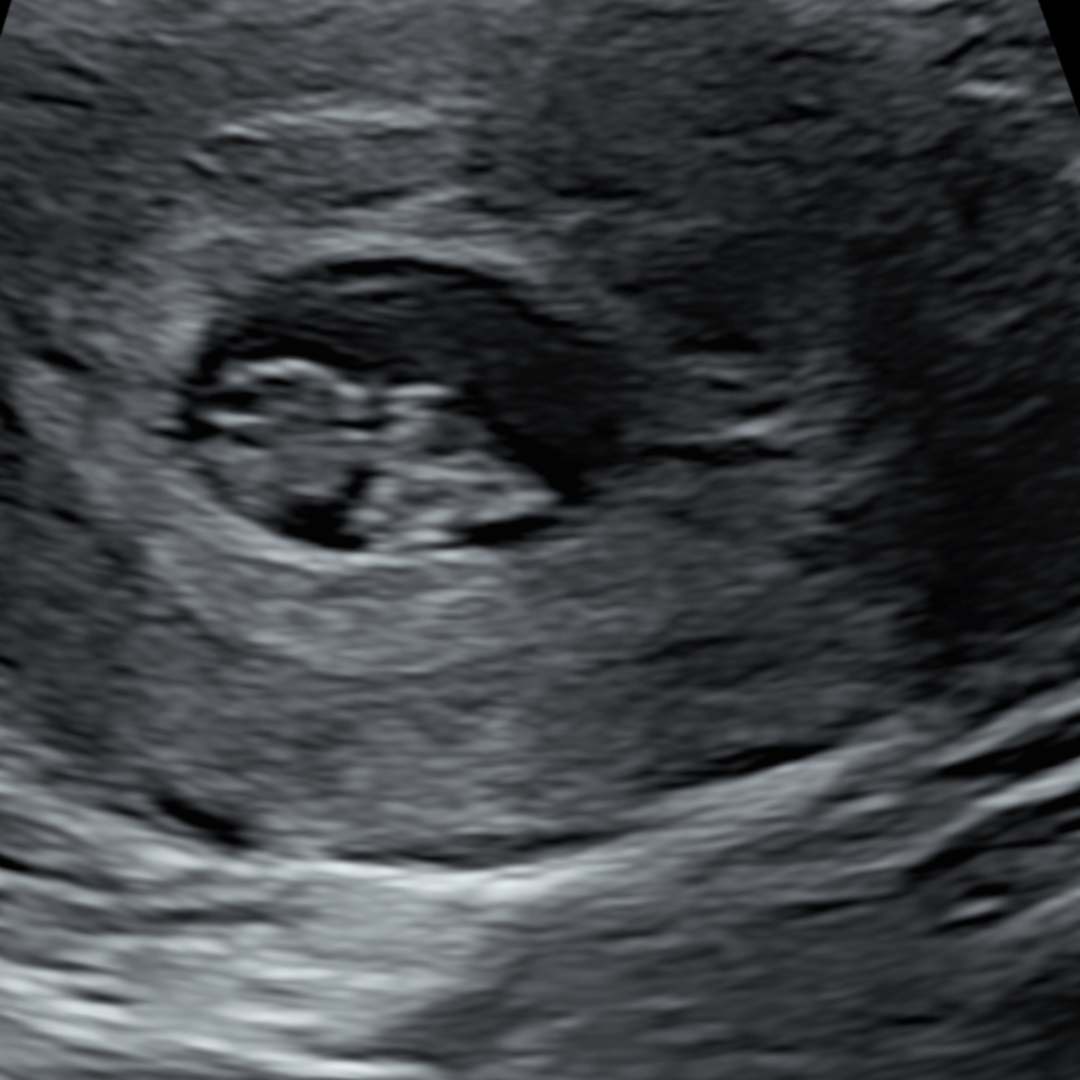 Photo shared by Erika for their Babylist baby registry.