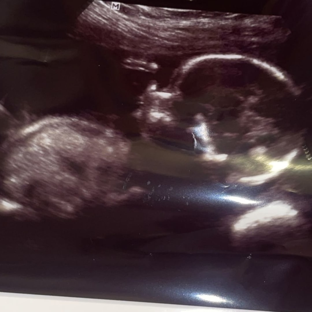 Photo shared by Shariffa for their Babylist baby registry.