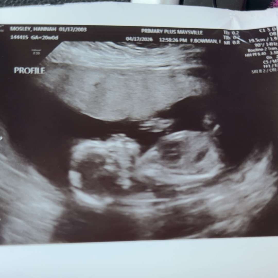 Photo shared by Hannah for their Babylist baby registry.