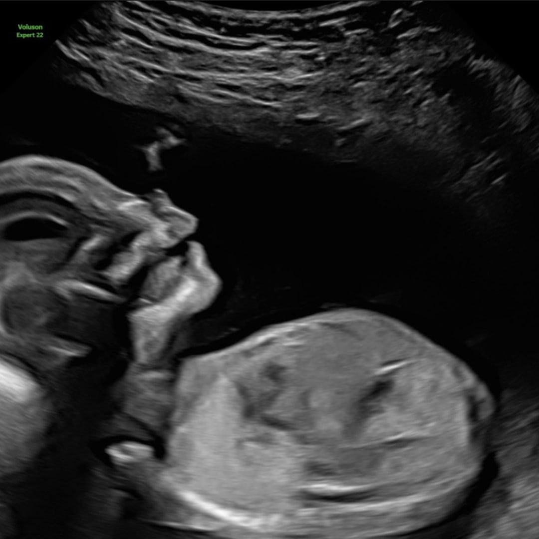 Photo shared by Morgan for their Babylist baby registry.