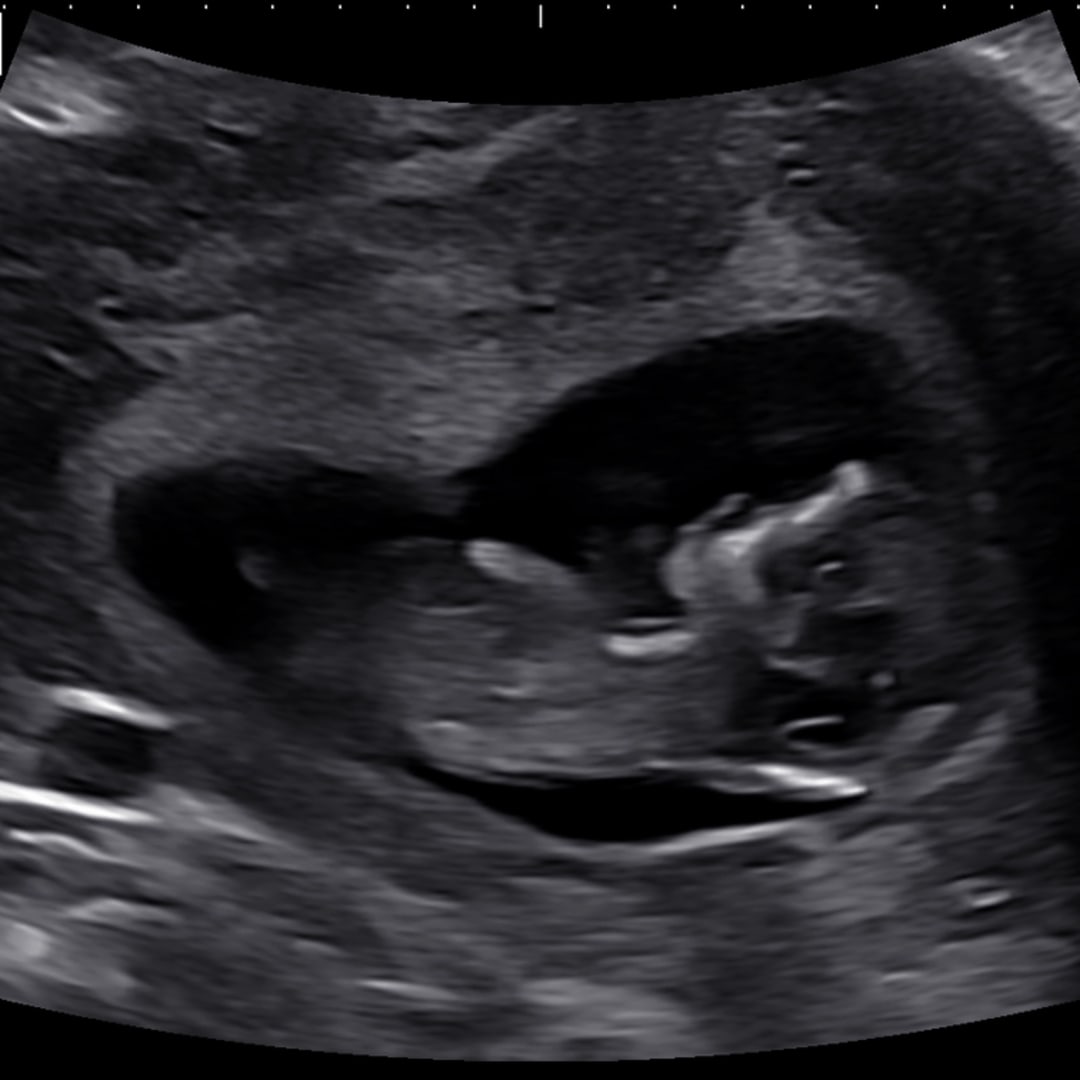 Photo shared by Jennifer for their Babylist baby registry.